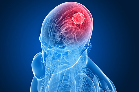 Traumatic Brain Injury